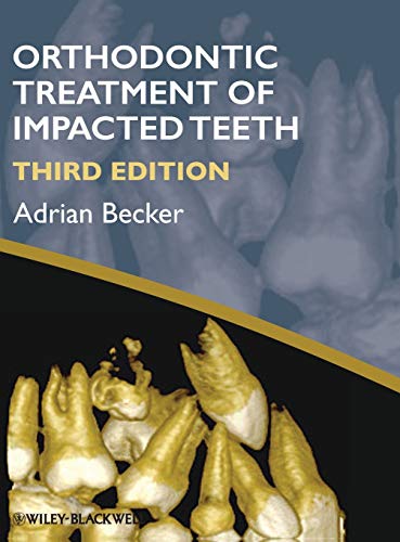 9781444336757: Orthodontic Treatment of Impac