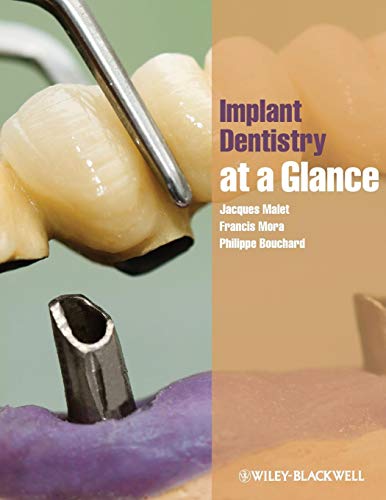 Beispielbild fr Implant Dentistry at a Glance zum Verkauf von ThriftBooks-Atlanta