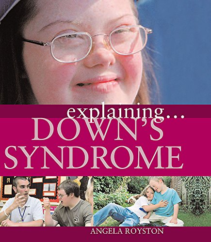 9781445117690: Explaining... Down's Syndrome