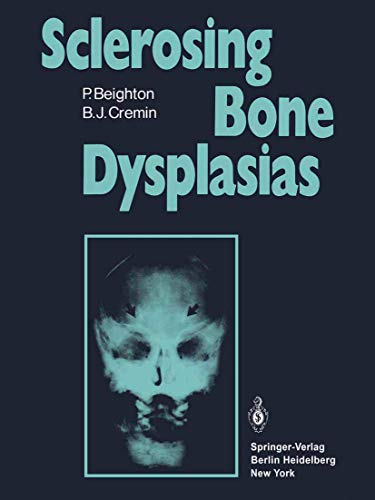 Imagen de archivo de Sclerosing Bone Dysplasias a la venta por Lucky's Textbooks