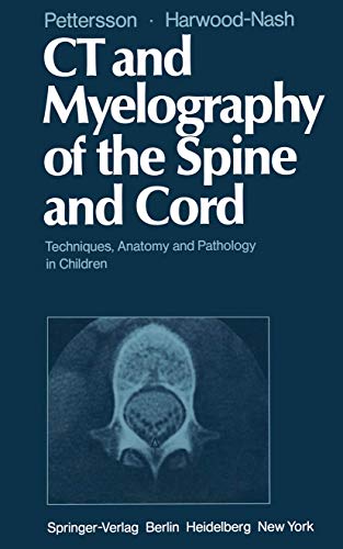 CT and Myelography of the Spine and Cord: Techniques, Anatomy and Pathology in Children (9781447113317) by Pettersson, H.; Harwood-Nash, D.C.F.