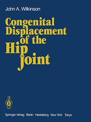 Beispielbild fr Congenital Displacement of the Hip Joint zum Verkauf von Blackwell's