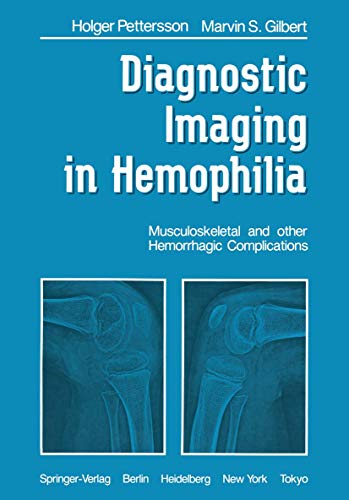 Stock image for Diagnostic Imaging in Hemophilia: Musculoskeletal and Other Hemorrhagic Complications for sale by THE SAINT BOOKSTORE