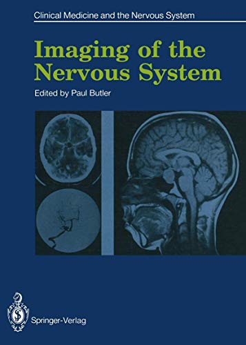 Imaging of the Nervous System (Clinical Medicine and the Nervous System) (9781447116394) by Butler, Paul