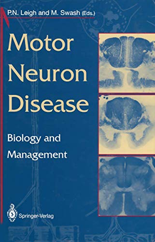 Beispielbild fr Motor Neuron Disease : Biology and Management zum Verkauf von Blackwell's