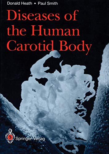 Diseases of the Human Carotid Body (9781447118763) by Heath, Donald; Smith, Paul