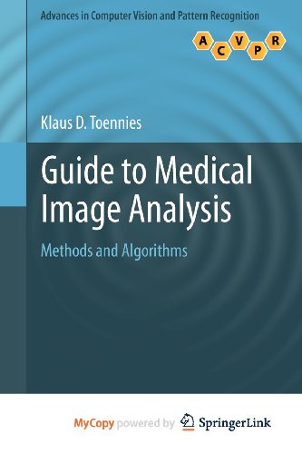 9781447127529: Guide to Medical Image Analysis: Methods and Algorithms