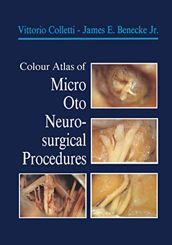 Imagen de archivo de Colour Atlas of Micro-oto-neurosurgical Procedures a la venta por Revaluation Books