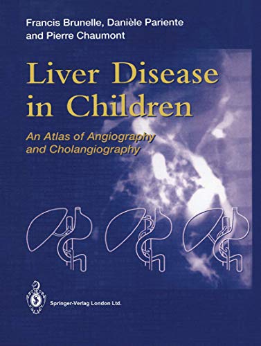 Stock image for Liver Disease in Children: An Atlas of Angiography and Cholangiography for sale by Lucky's Textbooks
