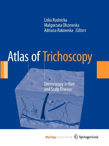 9781447144878: Atlas of Trichoscopy: Dermoscopy in Hair and Scalp Disease