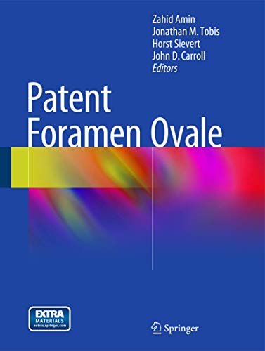 9781447149866: Patent Foramen Ovale