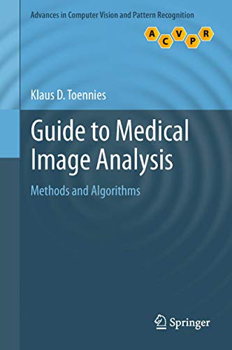 9781447160960: Guide to Medical Image Analysis: Methods and Algorithms (Advances in Computer Vision and Pattern Recognition)