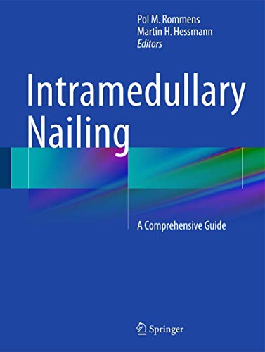 Stock image for Intramedullary Nailing: A Comprehensive Guide for sale by SpringBooks