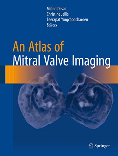 Beispielbild fr An Atlas of Mitral Valve Imaging zum Verkauf von SpringBooks