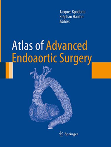 9781447168546: Atlas of Advanced Endoaortic Surgery