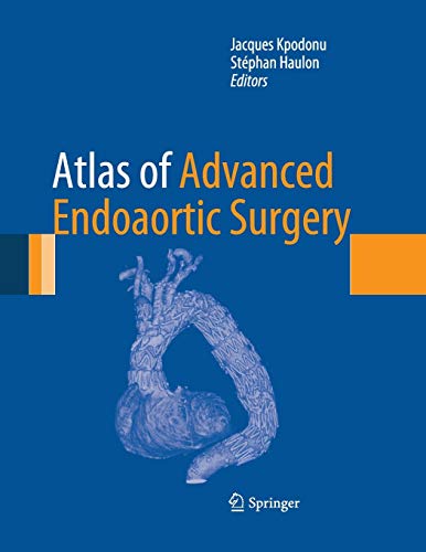 9781447168546: Atlas of Advanced Endoaortic Surgery