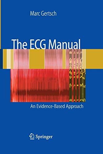 9781447168584: The ECG Manual: An Evidence-Based Approach