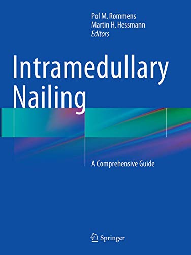 Stock image for Intramedullary Nailing: A Comprehensive Guide [Paperback] Rommens, Pol M. and Hessmann, Martin H. for sale by SpringBooks