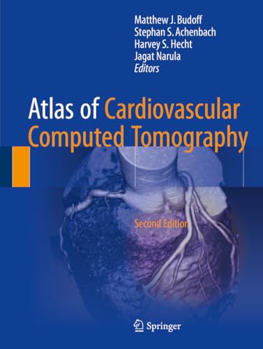 Stock image for Atlas of Cardiovascular Computed Tomography for sale by Better World Books Ltd
