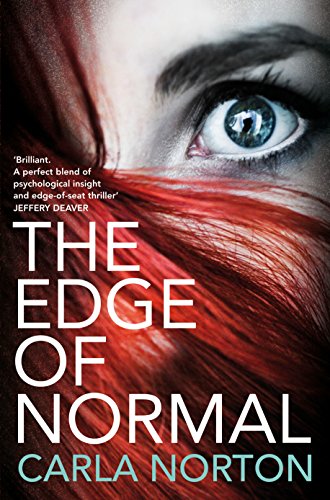 9781447230694: The Edge of Normal