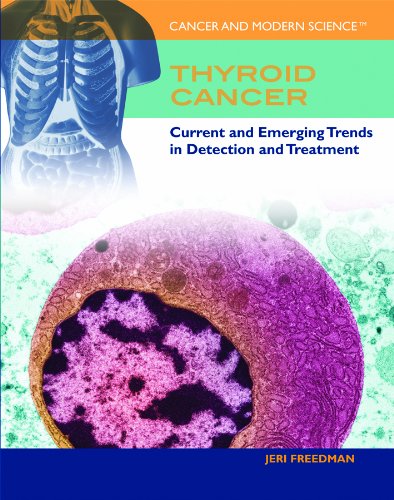 Stock image for Thyroid Cancer for sale by ThriftBooks-Atlanta