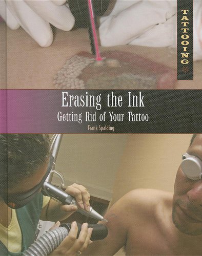9781448846153: Erasing the Ink: Getting Rid of Your Tattoo (Tattooing)