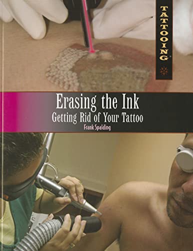 Beispielbild fr Erasing the Ink : Getting Rid of Your Tattoo zum Verkauf von Better World Books