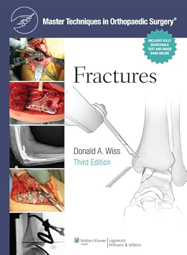 9781451108149: Fractures. Master Techniques In Orthopaedic Surgery