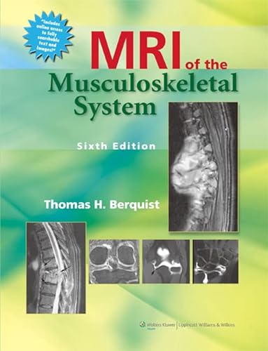 Stock image for MRI of the Musculoskeletal System for sale by TextbookRush