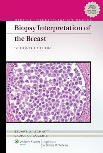 Stock image for Biopsy Interpretation of the Breast (Biopsy Interpretation Series) for sale by ZBK Books
