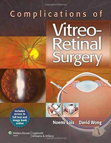 Imagen de archivo de Complications of Vitreo-Retinal Surgery a la venta por dsmbooks