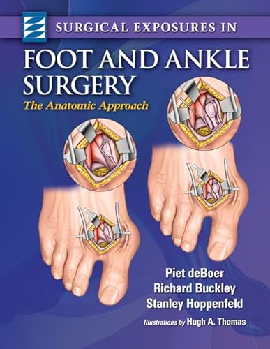 9781451144505: Surgical Exposures in Foot And Ankle Surgery: The Anatomic Approach