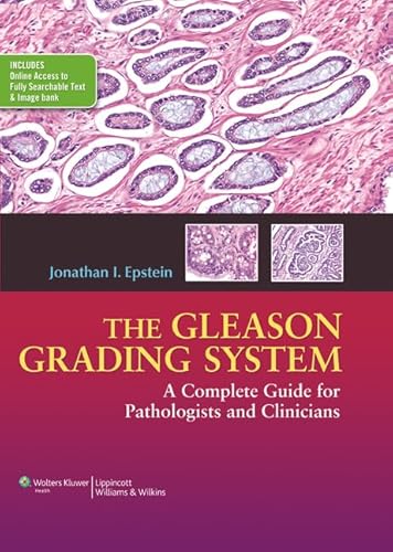 Imagen de archivo de The Gleason Grading System: A Complete Guide for Pathologist and Clinicians a la venta por Zoom Books Company