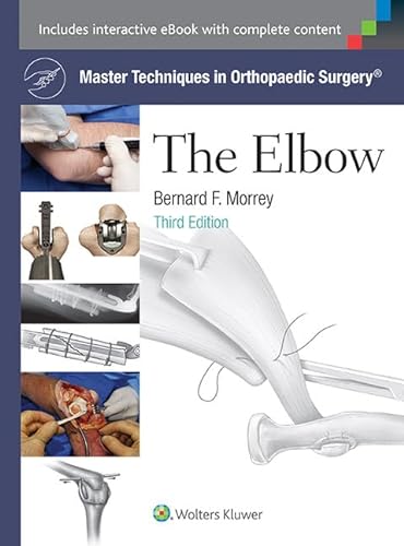 9781451173093: Master Techniques in Orthopaedic Surgery: The Elbow