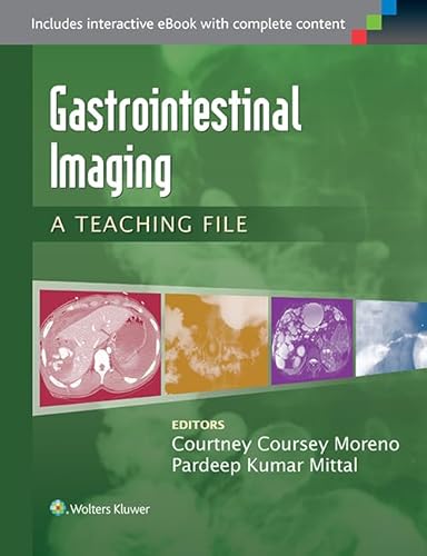 Beispielbild fr Coursey Moreno, C: Gastrointestinal Imaging: A Teaching File (LWW Teaching File Series) zum Verkauf von Studibuch