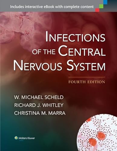 Beispielbild fr Infections of the Central Nervous System zum Verkauf von HPB-Red