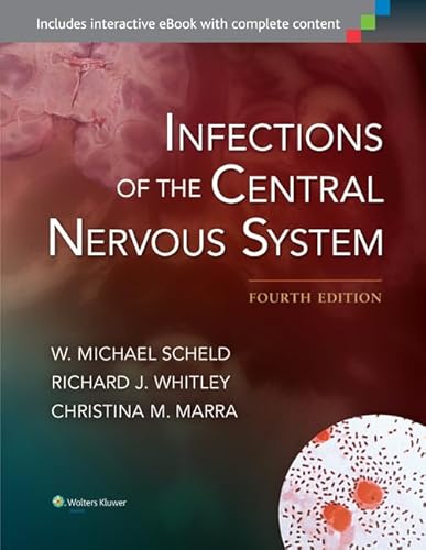 Stock image for Infections of the Central Nervous System for sale by HPB-Red