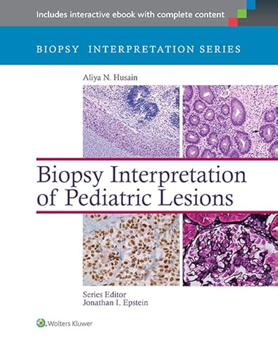 9781451175332: Biopsy Interpretation of Pediatric Lesions