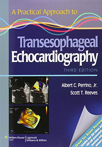 Stock image for A Practical Approach to Transesophageal Echocardiography for sale by HPB-Red