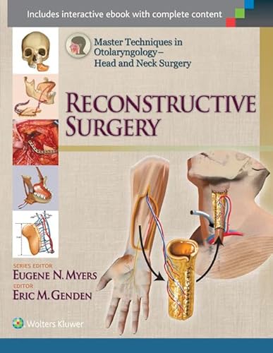 Stock image for Head and Neck Surgery: Reconstructive Surgery (Master Tecniques in Otolaryngology) for sale by Phatpocket Limited
