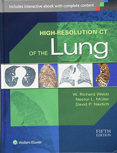 Imagen de archivo de High-Resolution CT of the Lung a la venta por Book Deals