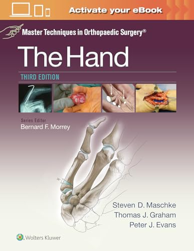 9781451182781: Master Techniques in Orthopaedic Surgery: The Hand