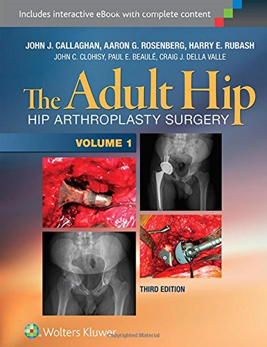 Imagen de archivo de The Adult Hip (Two Volume Set): Hip Arthroplasty Surgery a la venta por Scubibooks