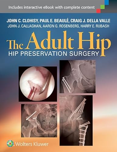 Imagen de archivo de The Adult Hip: Hip Preservation Surgery a la venta por GoldenWavesOfBooks