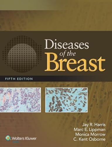 Stock image for Diseases of the Breast 5e for sale by Scubibooks