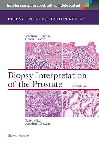 Imagen de archivo de Biopsy Interpretation of the Prostate (Biopsy Interpretation Series) a la venta por Books of the Smoky Mountains