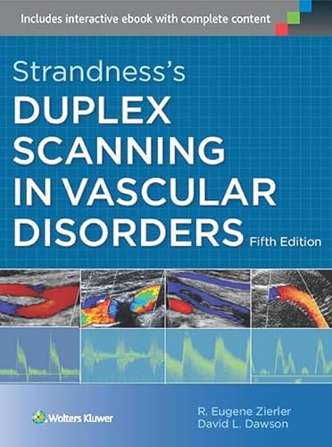 Imagen de archivo de Strandness's Duplex Scanning in Vascular Disorders a la venta por Scubibooks