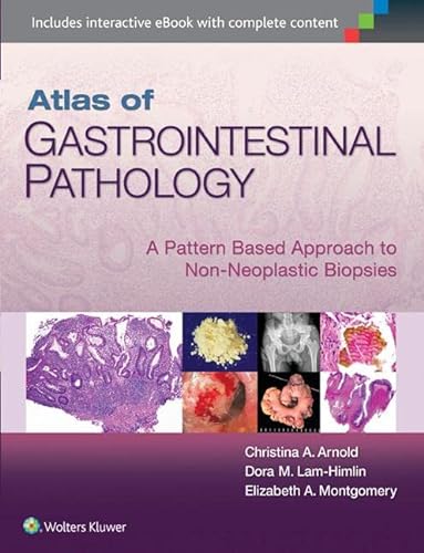 Beispielbild fr Atlas of Gastrointestinal Pathology: A Pattern Based Approach to Non-Neoplastic Biopsies zum Verkauf von Scubibooks