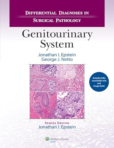9781451189582: Differential Diagnoses in Surgical Pathology: Genitourinary System