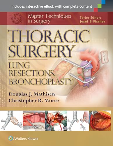 Stock image for Master Techniques in Surgery: Thoracic Surgery: Lung Resections, Bronchoplasty for sale by Scubibooks